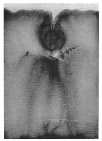 Silver Nitrate - Easter 1928