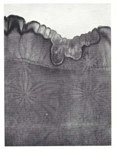 St. John's Festival (silver nitrate), 1927
